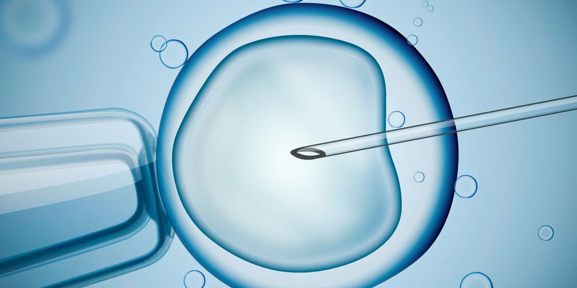 Intracytoplasmic sperm injection (ICSI)