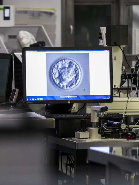 EMBRYOSCOPE MOBILE