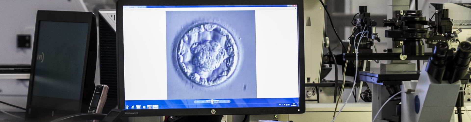 embryo transfer to increase success