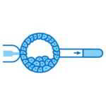 PREIMPLANTATION GENETIC TEST (PGT)