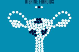 uterine fibroids