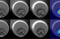 Applying AI to embryo selection