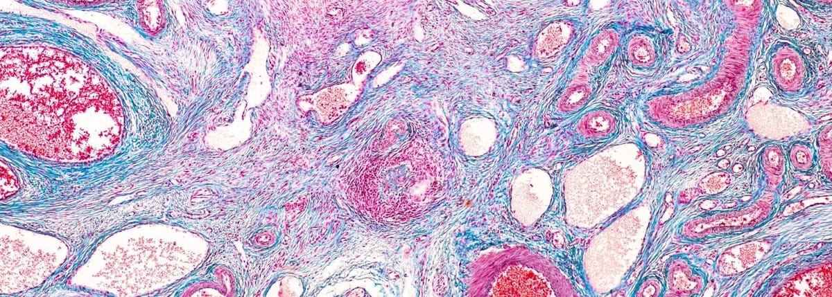 ovarian follicles