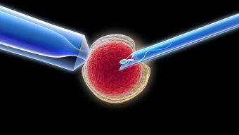 ICSI Explained: Success Rates, Risks and What to Expect