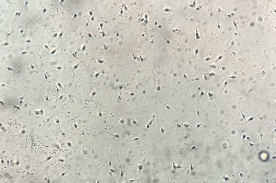 Vitamins to increase sperm count and boost male fertility