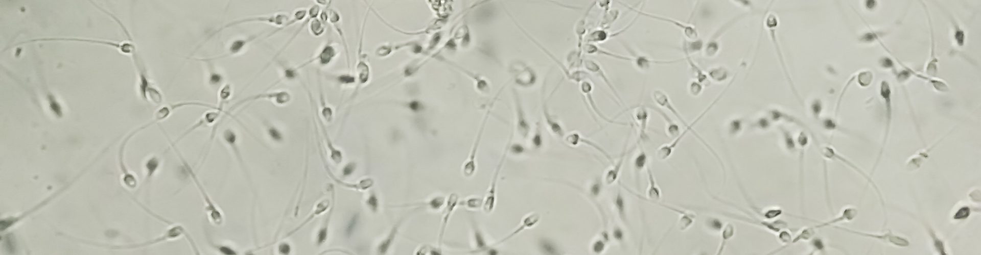 Normozoospermia analyzed by microscope. Semen analysis normal sp