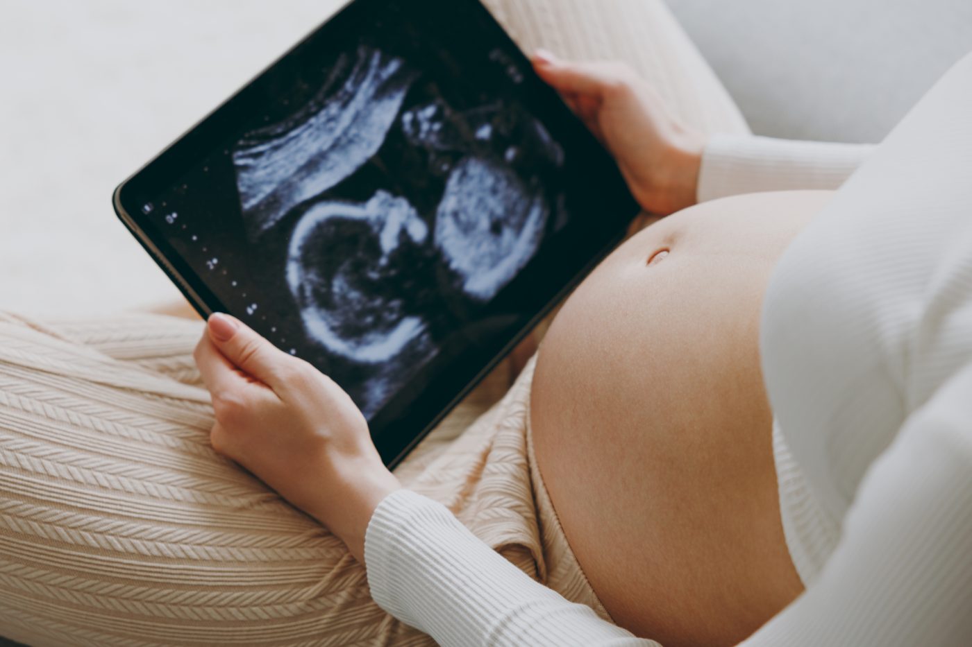 First pregnancy scan after In Vitro Fertilization treatment