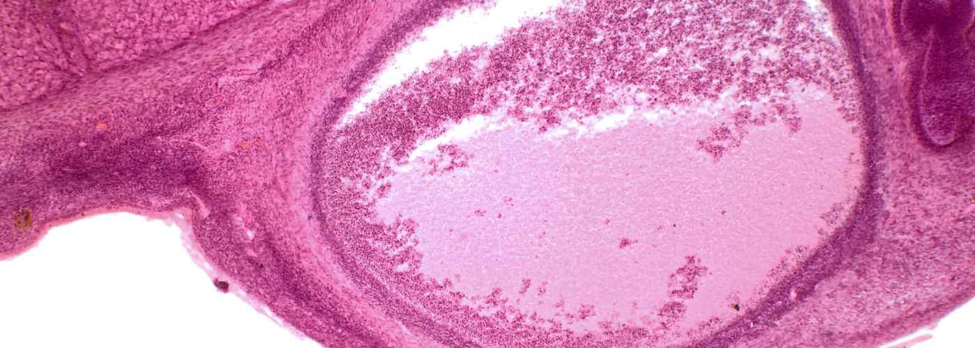 ovary size
