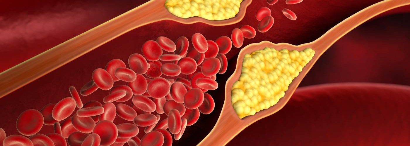 High cholesterol can affect fertility