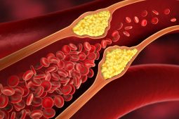 High cholesterol can affect fertility